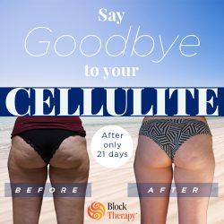 21 Day Cellulite BeforeAfter - 960x960